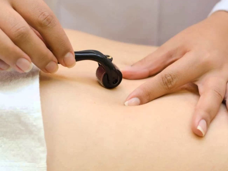 ĐIỀU TRỊ RẠN DA