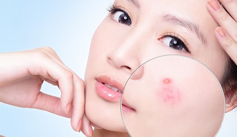 ĐIỀU TRỊ TRỨNG CÁ