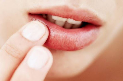 DỊCH BỆNH (MERS-CoV)