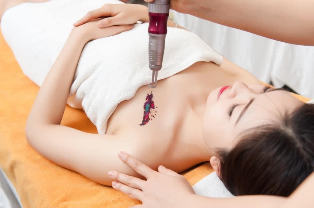 XÓA XĂM BẰNG LASER YAG